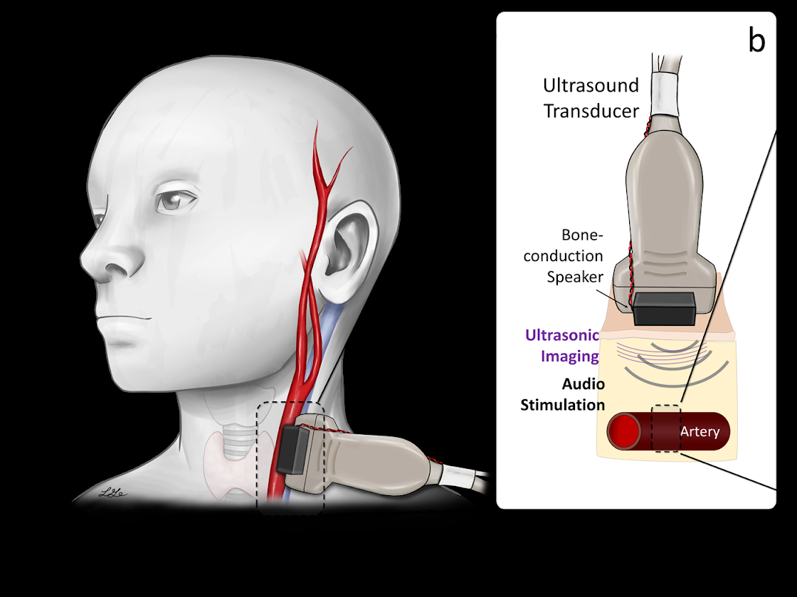 blood pressure